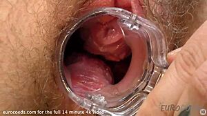Ginger Teen with Hairy Gash Shows Cervix in Speculum View