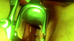 Can you believe how the cervix stretches and sounds?