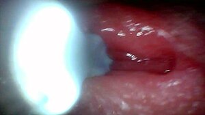 Endoscope Camera Records Male Ejaculation Moment