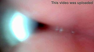 Endoscope Camera Records Male Ejaculation Moment
