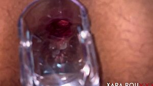 she spreads hairy huge ass for speculum ANAL GAPING