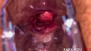 she spreads hairy huge ass for speculum ANAL GAPING